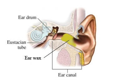 Ear Wax Removal